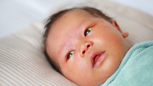 Newborn Jaundice Signs & Safety